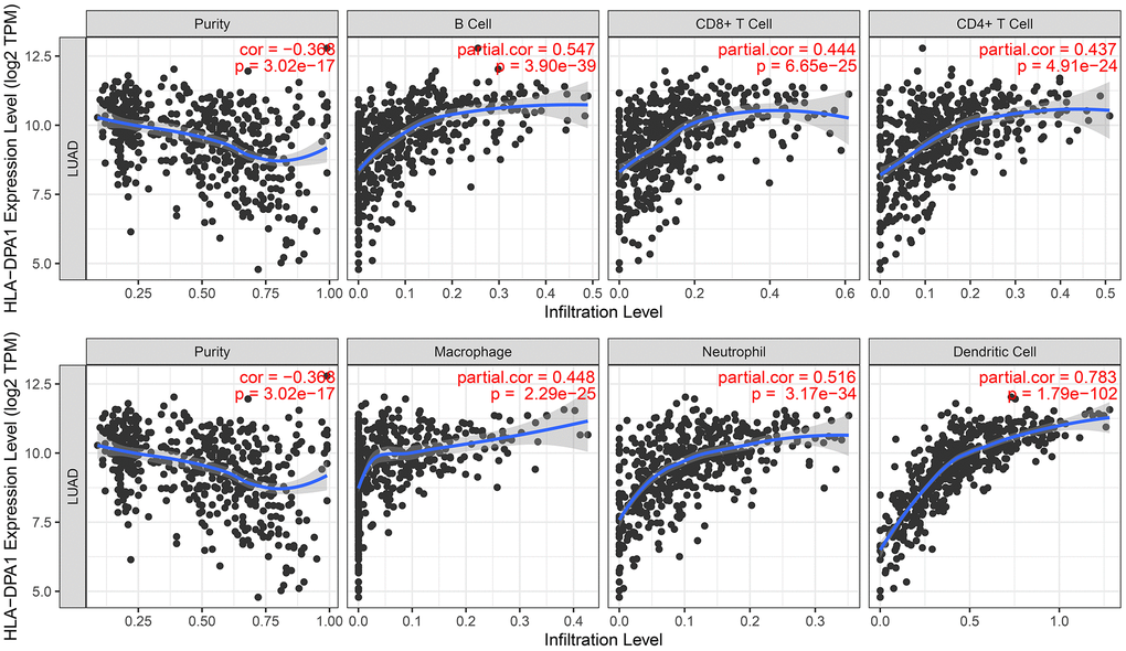 The association between the HLA-DPA1 overexpression and tumor purity and immune cells in LUAD using the TIMER database. Abbreviations: LUAD: lung adenocarcinoma; TIMER: Time Interval Medical Event Recorder.