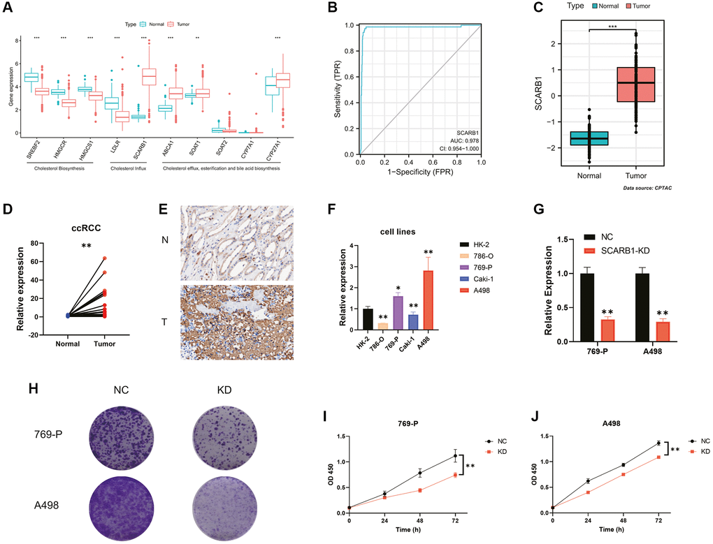 Screening and validation of the effects of SCARB1 in ccRCC. (A) Differential mRNA expression analysis of 10 CMGs between ccRCC and normal kidney tissues. (B) The AUC for SCARB1 in ccRCC cases was 0.9597. (C) Differential protein expression analysis of SCARB1 between ccRCC and adjacent cancerous tissues. (D) Comparison of mRNA expression levels of SCARB1 between ccRCC and adjacent cancerous tissues; n = 30. (E) IHC staining of SCARB1 in clinical ccRCC and adjacent cancerous tissues; N: adjacent cancerous tissue; T: ccRCC tissues. (F) Comparison of mRNA expression levels of SCARB1 in HK-2 and RCC cell lines by RT-qPCR; n = 3. (G) The knockdown efficiency of si-SCARB1 was verified by evaluating SCARB1 mRNA expression using RT-qPCR; n = 3. (H) Comparison of the clone formation ability between negative control groups and SCARB1 knockdown groups in 769-P and A498 cells. Abbreviations: NC: negative control; KD: knockdown; OD: optical density. (I, J) Cell proliferation curve following transfection of si-SCARB1 in (I) 769-P and (J) A498 cells. *p-value **p-value ***p-value 