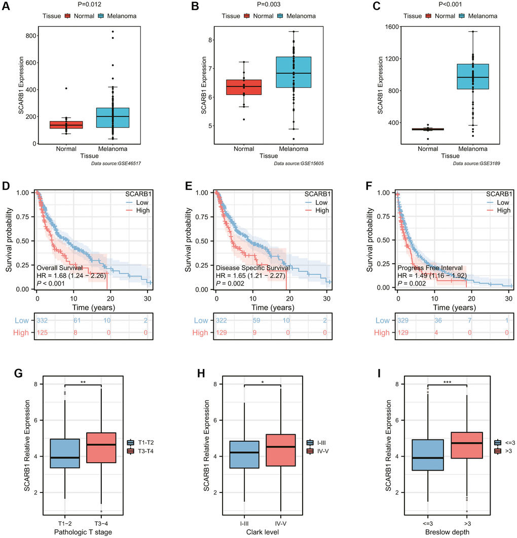 Exploration of the expression and prognostic ability of SCARB1 in SKCM. (A–C) Differential mRNA expression analysis of SCARB1 between cutaneous melanoma and normal skin tissues from the GEO database, including (A) GSE46517, (B) GSE15605, and (C) GSE3189. (D–F) The K-M survival curves showing the poorer survival probability of SKCM patients in the high-SCARB1 group with different observation end points, including (D) overall survival, (E) disease specific survival, and (F) progress free interval. (G–I) Differential mRNA expression analysis of SCARB1 between SKCM patients stratified by classic prognostic predictors, including (G) pathologic T stage, (H) Clark level, and (I) Breslow depth. *p-value **p-value ***p-value 