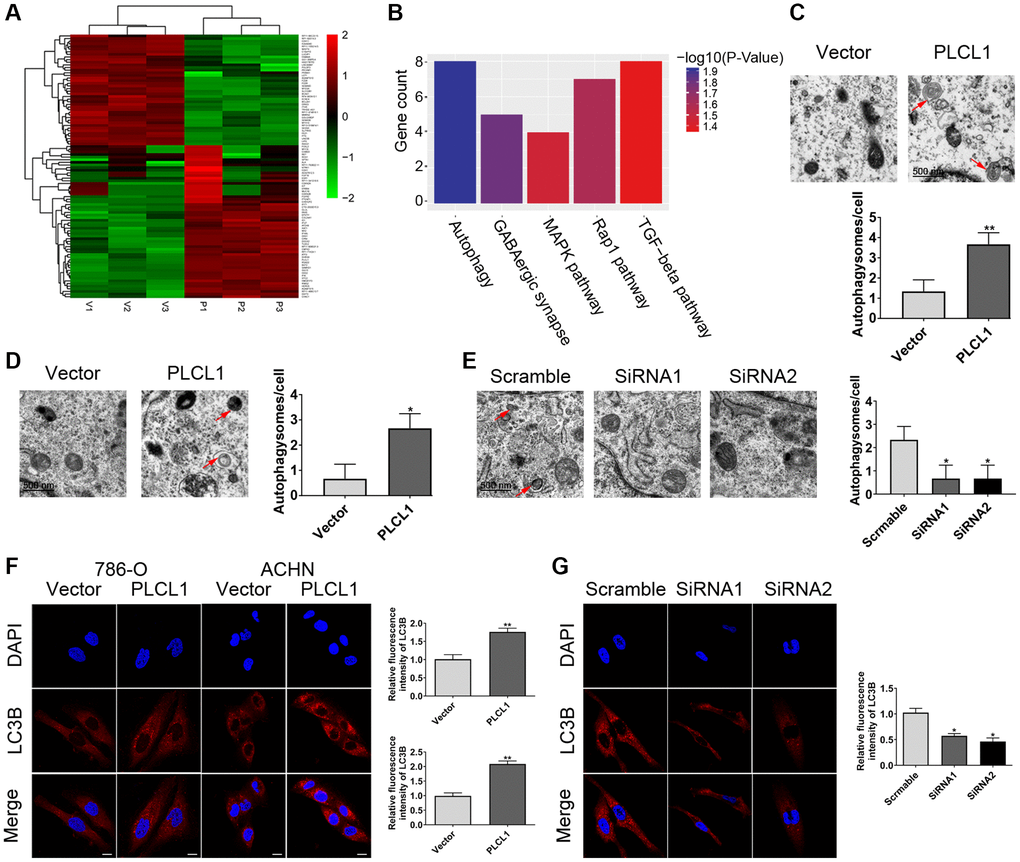 PLCL1 facilitates autophagy in RCC cells. (A) The heatmap of clustering analysis according to the sequencing of differentially expressed genes. (B) KEGG pathway enrichment analysis of the top five results. (C–E) Transmission electron microscopy indicating the formation of autophagosomes or autolysosomes in RCC cells. Red arrows: autophagosomes or autolysosomes. Scale bar: 1 μm. (F) 786-O and ACHN cells transfected with PLCL1 lentivirus and vector were subjected to immunofluorescence and quantitative analysis for LC3B. Scale bar, 20 μm. (G) Representative confocal images and quantitative analysis of LC3 dots in 769P cells transfected with siRNA-scramble, siRNA-PLCL1 #1, and shRNA-PLCL1 #2. Scale bar, 20 μm. Data are shown as the mean ± SE from three independent experiments. Student’s t test was performed to determine statistical significance between two groups. *P 