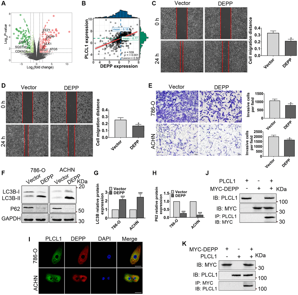 PLCL1 promotes autophagy by interacting with DEPP. (A) Volcano plot of autophagy-related DEGs (eight candidates, black colour) in 786-O cells with PLCL1 overexpression and vector cell sequencing. The red dots in the volcano represent upregulated DEGs, and the green dots represent downregulated DEGs, while black dots represent non-significant DEGs. (B) The association between PLCL1 and DEPP was calculated using Pearson analysis. (C, D) Wound healing assays were used to determine the role of DEPP in RCC in vitro and quantification analyses of the results. Scale bar: 100 μm. (E) Transwell assays were performed in 786-O and ACHN cells transfected with DEPP or vector control. Scale bar: 100 μm. (F–H) Western blots of LC3B and P62 were performed in 786-O and ACHN cells transfected with DEPP or vector control. (I) 786-O and ACHN cells were immunofluorescently stained with PLCL1 (green) and DEPP (red) antibodies to assess colocalization using a confocal microscope. Scale bar, 20 μm. (J, K) Interaction between PLCL and DEPP in 786-O cells. The coimmunoprecipitates were utilized for western blotting with anti-PLCL1 and anti-MYC antibodies. Data are shown as the mean ± SE from three independent experiments. Student’s t test was performed to determine statistical significance between two groups. *P **P ***P 