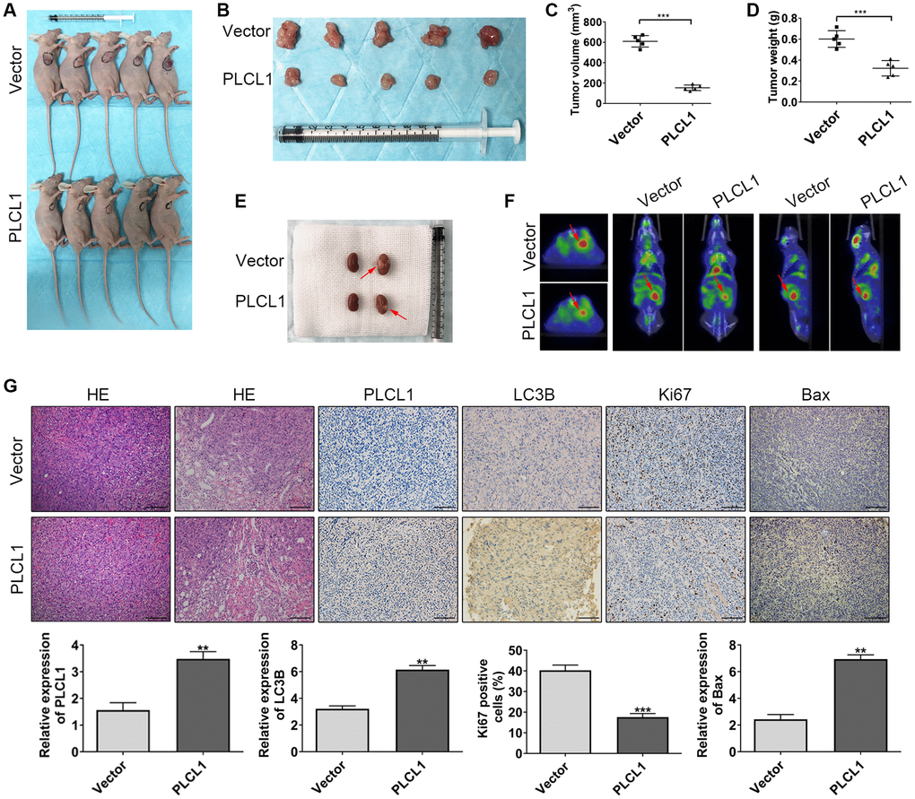 PLCL1 suppresses RCC tumour proliferation in vivo. (A, B) Representative images of PLCL1 and PLCL1-control RCC tumour growth in Balb/c nude mice. The tumour volume (C) and weight (D) in the xenograft tumour model are shown. (E) Representative images of renal orthotopic models between PLCL1 and vector control samples. (F) Representative PET scan results of the mouse orthotopic model. (G) HE, immunohistochemistry and quantitative analyses of PLCL1, LC3B, Ki67 and Bax in mouse tumour specimens. Each group n = 5. Student’s t test was performed to determine statistical significance between two groups. Scale bar: 100 μm. **P ***P 