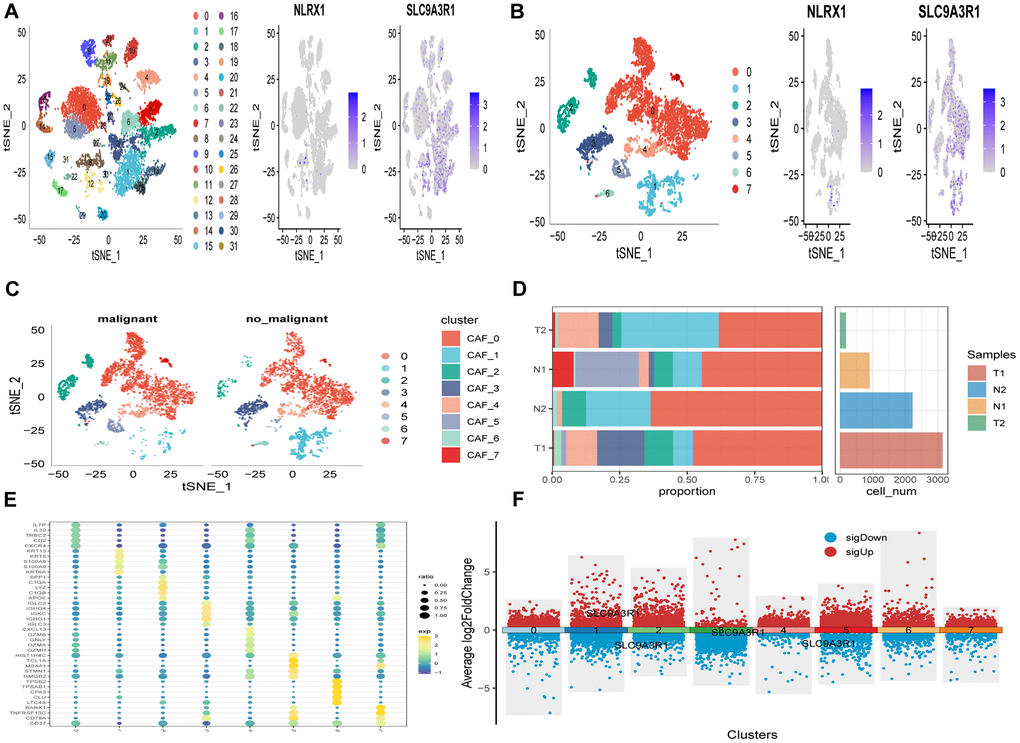 The identification of SCRGs clusters according to scRNA data of ESCC patients. (A) tSNE plots of distribution of 32 clusters and SARS-CoV-2 marker genes expression. (B) tSNE plots of distributions of eight fibroblasts after clustering. (C) tSNE distribution of malignant and non-malignant cells predicted by copycat package. (D) Subgroups in cancer and adjacent tissue and proportion as well as cell number calculation. (E) Bubble diagram of the top5 marker gene expression of subgroups. (F) Volcano plot of the top5 marker gene expression of subgroups.