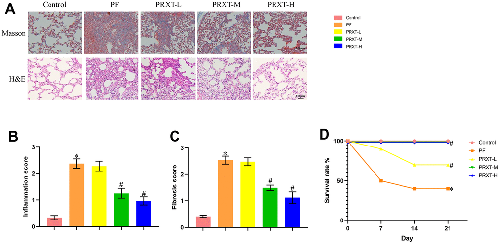 PRXT treatment ameliorated lung pathological injury and improved survival rate in bleomycin-induced mice. (A) Representative images of H&E staining and Masson staining in the indicated groups (n=5). (B, C) Inflammation score and fibrosis score based on H&E staining and Masson staining (n=5). (D) Survival rate of each group (n=10). *P #P −1·day−1). PRTX-M, Paroxetine-Medium dose (5 mg·kg−1·day−1). PRTX-H, Paroxetine-High dose (7.5 mg·kg−1·day−1).