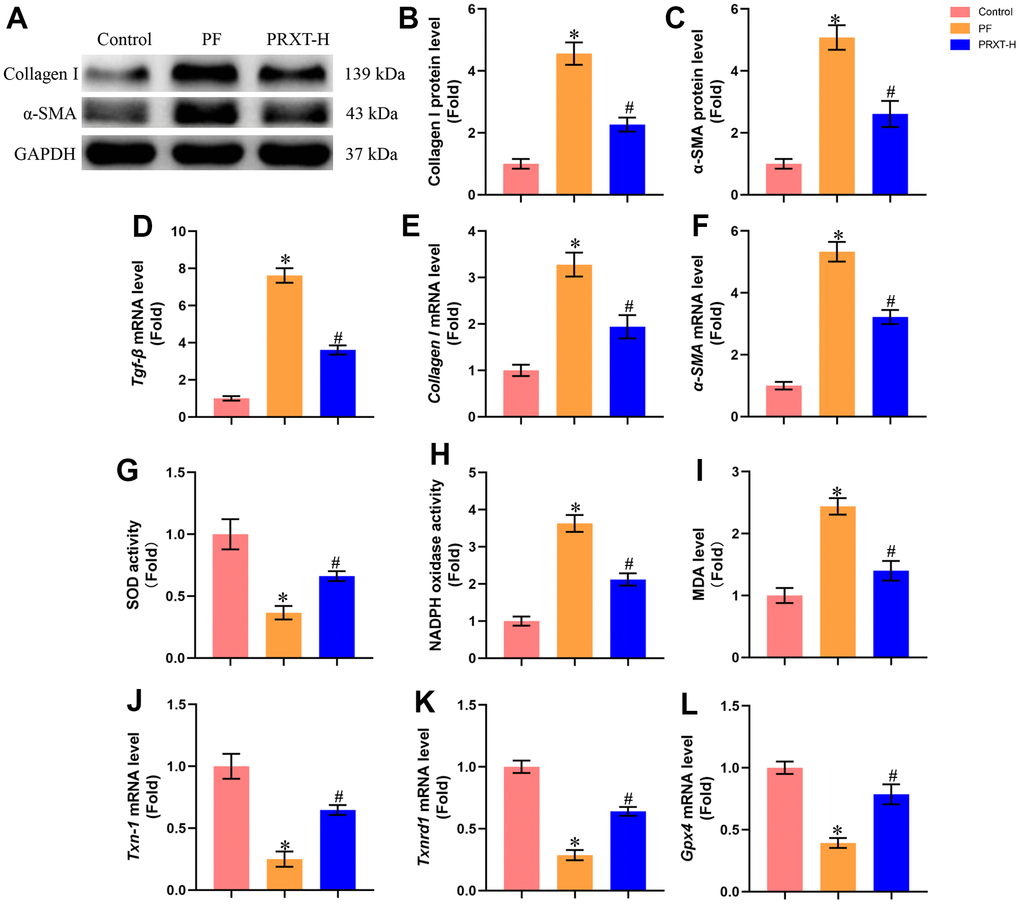 PRXT treatment suppressed collagen synthesis, inflammation and oxidative stress in bleomycin-induced mice. (A–C) Representative western blotting images of Collagen I and α-SMA and their quantification in murine lung tissues (n=5). (D–F) Relative mRNA expression levels of Tgf-β, Collagen I and α-SMA in murine lung tissues (n=5). (G) SOD activity (n=5). (H) NADPH oxidase activity (n=5). (I) MDA level (n=5). (J–L) Relative mRNA expression levels of Txn-1, Txnrd1, and Gpx4 in murine lung tissues (n=5). *P #P −1·day−1).