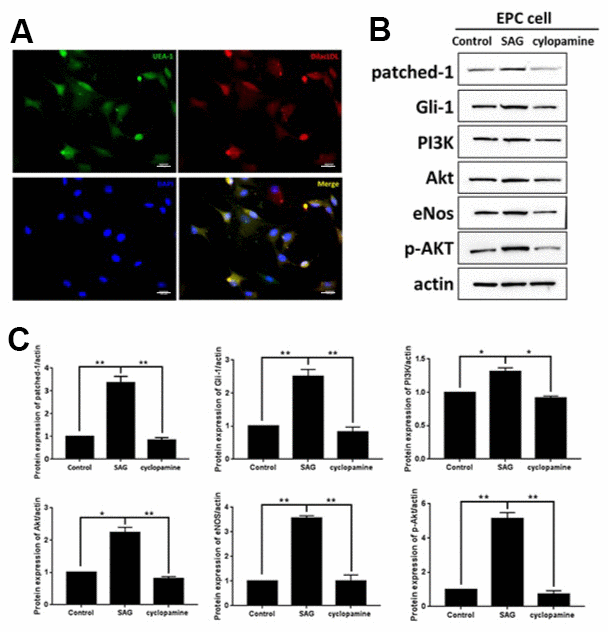 SHH pathway regulates PI3K/AKT/eNOS signaling in EPCs. (A) The EPCs were isolated from the mononuclear cells (MNCs). The DiI-acLDL and bind fluorescein iso-thiocyanate UEA-1 were analyzed by immunofluorescent analysis in the EPCs. Scale bar: 10 μm. (B) The EPCs were treated with SAG (1 μM) or cyclopamine (10 μM). (C) The patched-1, Gli-1, PI3K, Akt, eNOS expression and the Akt phosphorylation were tested by Western blot analysis in the EPCs. N = 3, mean ± SD, *pp