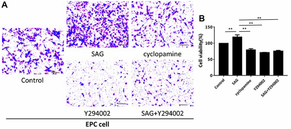 SHH pathway enhances proliferation and migration of EPCs by PI3K/AKT/eNOS signaling. (A, B) The EPCs were treated with SAG (1 μM), cyclopamine (10 μM), Y294002 (5 μM), or co-treated with SAG (1 μM) and Y294002 (5 μM). (A) The cell migration was examined by Transwell assays. (B) The cell proliferation was determined by CCK-8 assays. N = 3. Scale bar: 20 μm.