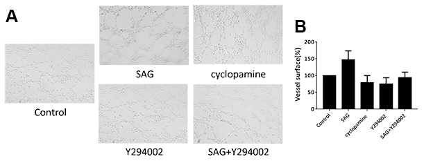 SHH pathway induces angiogenesis properties of EPCs by PI3K/AKT/eNOS signaling. (A, B) The EPCs were treated with SAG (1 μM), cyclopamine (10 μM), Y294002 (5 μM), or co-treated with SAG (1 μM) and Y294002 (5 μM). The angiogenesis properties were analyzed by tube formation assays. N = 3.