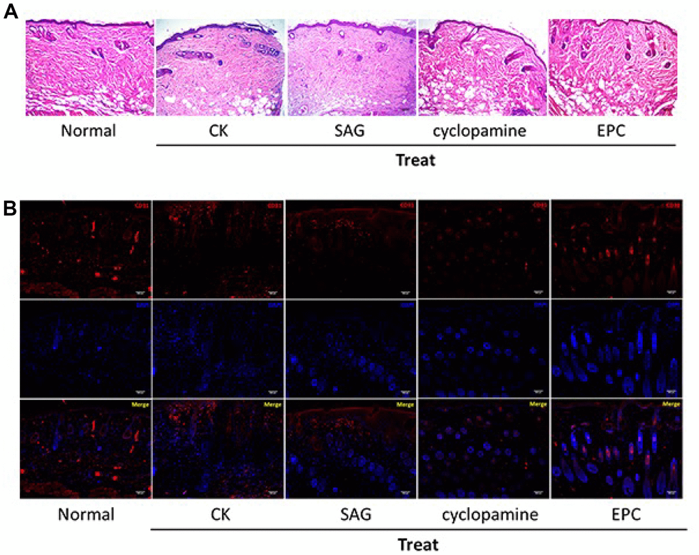 SHH pathway improves pressure ulcers healing in the rat model. (A, B) The pressure ulcers rat model was constructed, and the rats were treated with EPCs, or SAG or cyclopamine-treated EPCs, respectively. (A) The wound injury was analyzed by H&E staining in the rats. The representative wound healing images were shown. N = 5. (B) The pressure ulcers rat model was constructed, and the rats were treated with EPCs, or SAG or cyclopamine-treated EPCs, respectively. The angiogenesis was analyzed by the accumulation of CD31 based on immunofluorescent analysis in the rats. N = 5.