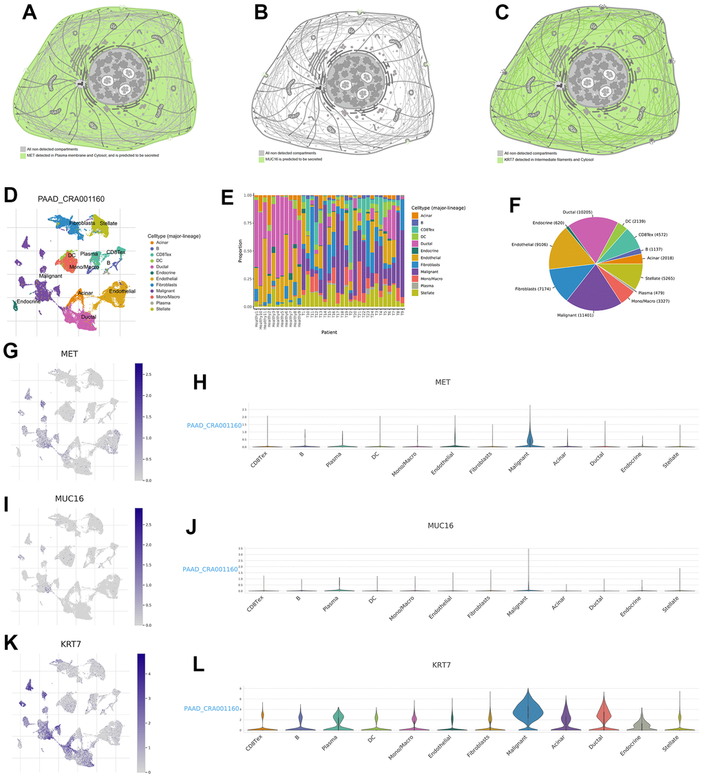 Expression distribution of MET, MUC16, and KRT7 and single-cell analysis. The expression distribution of MET (A), MUC16 (B), and KRT7 (C) in different cell substructures. (D) Annotation of each cell subset. (E) The proportion of each cell subset in each sample. (F) The percentages of each cell in pancreatic tumour microenvironment. (G, H) The distribution and proportion of MET expression within each cell subset. (I, J) The distribution and proportion of MUC16 expression in each cell subset. (K, L) The distribution and proportion of KRT7 expression in each cell subset.