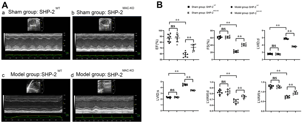 SHP2MAC-KO improves the cardiac function in mice with myocardial infarction. (A) Ultrasound imaging of mice in sham: SHP2WT group, sham: SHP2MAC-KO group, Model: SHP2WT group and Model: SHP2MAC-KO mice; (B) Statistics of EF, FS, LVAW; d, LVAW; s, LVID; d and LVID; s. P0.05.