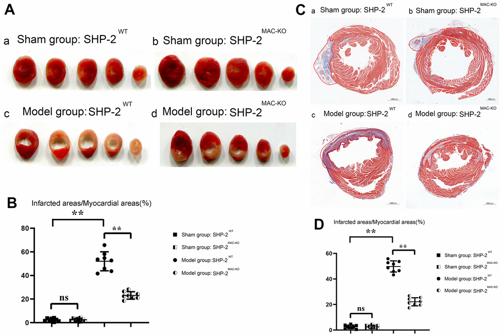 SHP2MAC-KO reduces myocardial infarct size in mice. (A) TTC results; (B) percentage of infarct size in each group; (C) Plot of Masson Staining result; (D) Myocardial infarction area statistics. **P0.05.