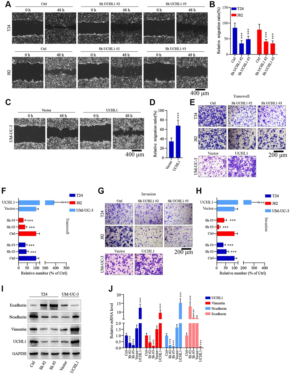 UCHL1 promotes the motility capacity of UBC cells in vitro. (A–D) Wound healing assay to investigate the influences of UCHL1 expression modulation on UBC tumor cell motility. Relative migration ratio of each cell group was statistically compared in bar charts (n = 3). (E–H) Transwell and cellular invasion assay to detect the impact of UCHL1 modulation on UBC tumor cell migration and invasion capabilities. Relative number of migrated or invaded cells of each group was statistically compared in bar charts (n = 3). (I, J) WB/qRT-PCR quantification of EMT biomarkers (E-cadherin, N-cadherin, Vimentin) in UBC cell groups transfected with UCHL1 shRNAs or overexpression vectors (n = 3).