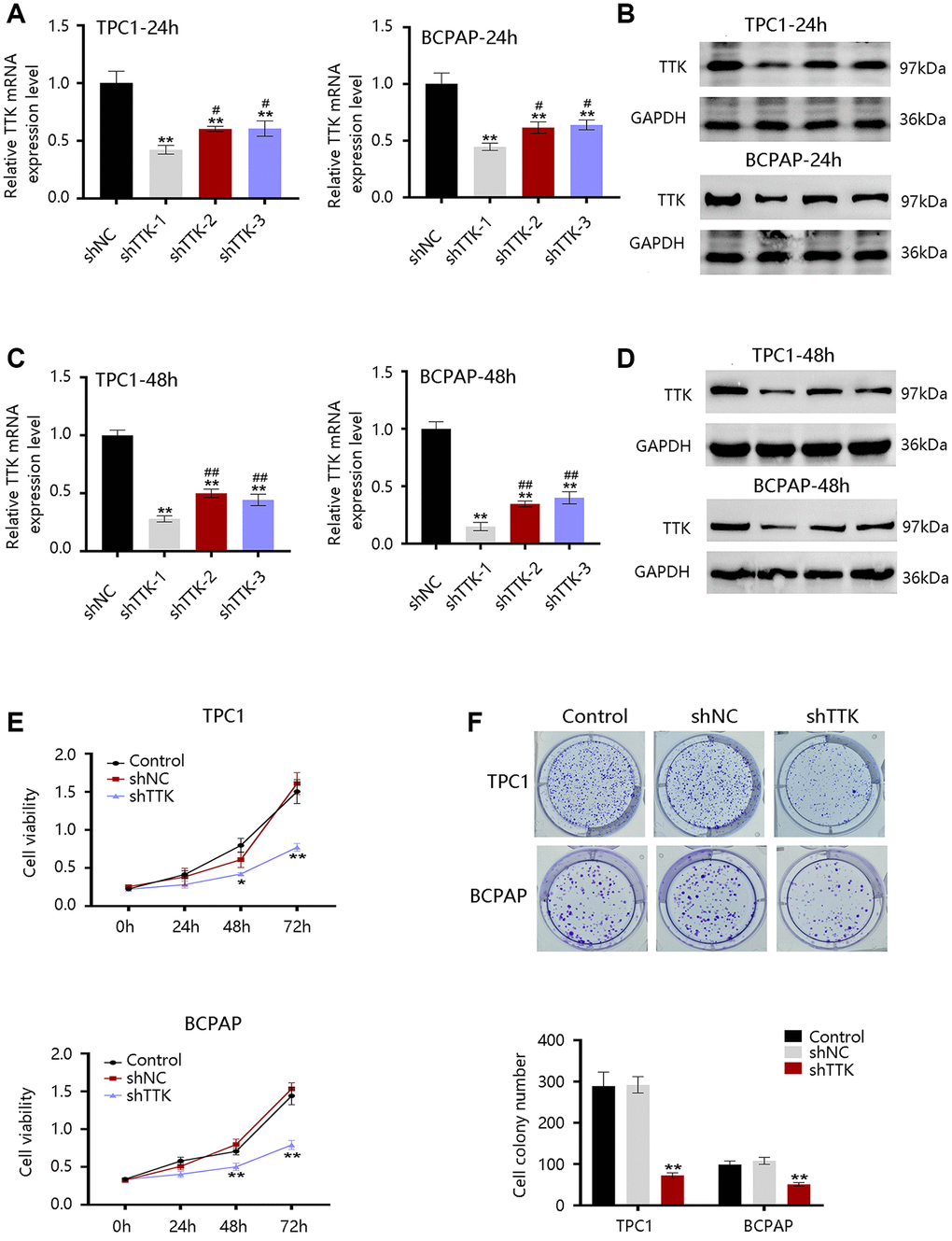 Effect of TTK on PTC cell growth. TTK knockdown efficiency of cells transfected with scrambled shRNA (shNC) or shRNAs against TTK (shTTK) for (A, B) 24 h and (C, D) 48 h in TPC1 and BCPAP cells. (E) The viability of TPC1 and BCPAP cells following TTK knockdown. (F) Representative images (up) and quantification (down) of colony formation assays of two cells. Compared with shNC, *P **P #P ##P 