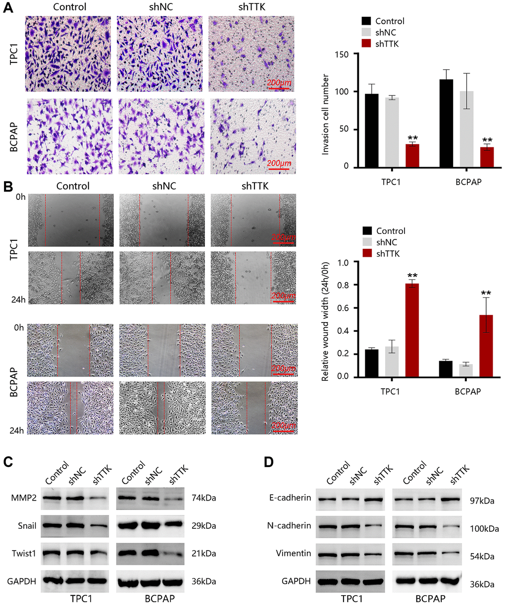 TTK promotes PTC cell invasion and migration. (A) The invasion of TPC1 and BCPAP cells transfected with shNC or shTTK and control for 24 h was measured by transwell invasion assay. (B) The migration of two PTC cells was assessed by wound-healing assay. Western blot for (C) metastasis-related proteins and (D) EMT maser genes in TTK-knockdown TPC1 and BCPAP cells. Compared with shNC, **P 