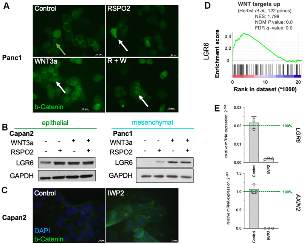 LGR6 as a WNT target gene. (A) Immunofluorescence staining of β-catenin (green) in Panc1 after stimulation with RSPO2, WNT3a or its combination (R+W) showed more nuclear staining upon WNT activation, in particular with WNT3a or R+W. White arrows indicate nuclear β-catenin, green arrows indicate membrane-bound β-catenin. (B) Western blot of LGR6 after similar stimulation showed increase in both Capan2 and Panc1. (C) GSEA of TCGA data revealed positive correlation of LGR6 with the WNT signature “WNT targets up” by Herbst et al. (D) Immunofluorescence staining of β-catenin in Capan2 reveals increase in membrane-bound and decrease of nuclear β-catenin upon IWP2 inhibition. The cells were cultured with 10uM IWP2 for 72h, medium was changed every other day. Bar, 20 μm; (E) Effect of IWP2 on AXIN2 and LGR6 mRNA expression in Capan2. Significant decreases were detected in presence of IWP2. ***, P