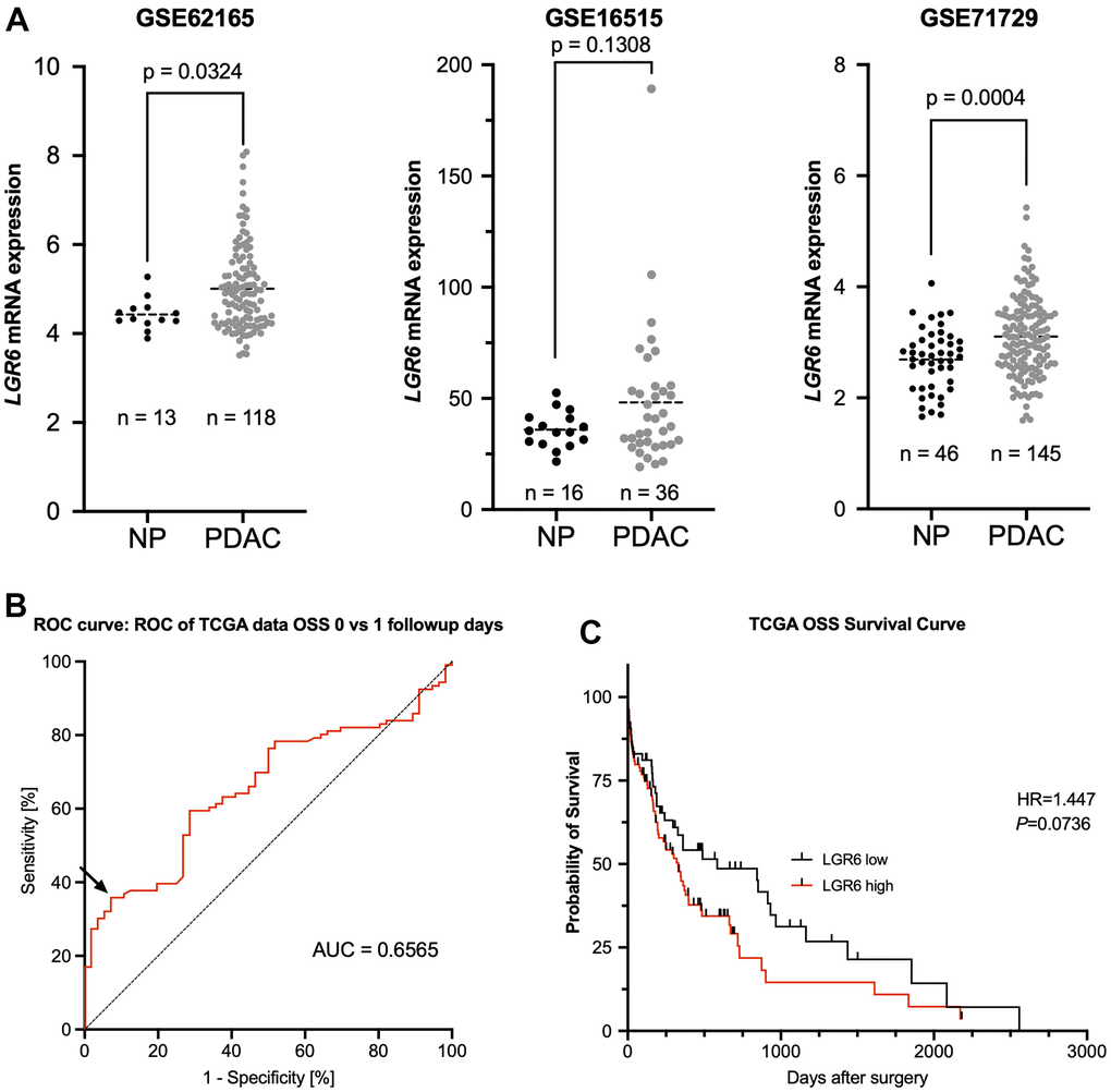 LGR6 is higher expressed in PDAC compared to normal tissue and trends towards worse overall survival. (A) Analysis of publicly available datasets (GSE62165, GSE16515, and GSE71729) shows significantly more LGR6 in tumor vs. normal pancreatic tissue (NP). (B) ROC curve analysis of normalized LGR6 mRNA expression for best discrimination threshold with an area under the curve (AUC) of 0.6565. (C) Dichotomal classification revealed a trend of high LGR6 expression and poor overall survival; survival of PDAC patients of LGR6high versus LGR6low is decreased without statistical significance.