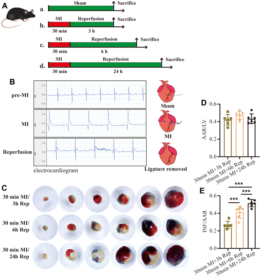 Influence of duration of reperfusion time on infarct size. (A) Flow chart of the experimental protocols. (B) Representative ECG tracings of each group in mice. (C) Representative images of 2,3,5-triphenyltetrazolium chloride (TTC) staining and quantification of the area at risk/left ventricular weight (D, AAR/LV) ratio and the infarct size/area at risk (E, INF/AAR) ratio (n = 6 : 6 : 6). MI=Myocardial infarction, Rep=reperfusion. Data are shown as mean ± SD. One-way ANOVA followed by Tukey post hoc test was used for statistical comparisons between multiple groups. ***P 