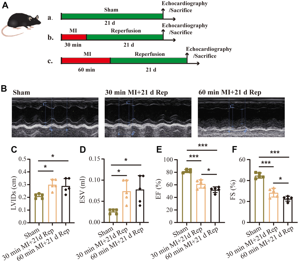 Effect of different durations of ischemia on heart failure after reperfusion. (A) Flow chart of the experimental protocols. (B) Representative echocardiographic images and statistical data of left ventricular internal dimension in systole (C, LVIDs), end-systolic volume (D, ESV), left ventricular ejection fraction (E, EF%), fractional shortening (F, FS%) of mice (n = 5 : 5 : 5 : 5). MI=Myocardial infarction, Rep=reperfusion. Data are shown as mean ± SD. One-way ANOVA followed by Tukey post hoc test was used for statistical comparisons between multiple groups. *P P 