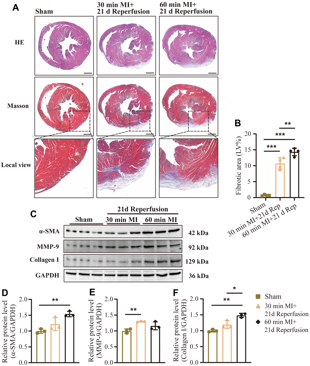 Effect of different durations of ischemia on cardiac remodeling after reperfusion. (A) Representative images of HE and Masson’s trichrome staining and (B) quantification of fibrotic area (%) in mouse hearts treated as indicated (n = 4 : 4 : 4 : 4). Scale bar: 500 μm. (C) Representative western blot and (D–F) statistical data of myocardial fibrosis by detection of (D) α-SMA, (E) MMP-9, and (F) collagen I expression levels in mouse hearts treated as indicated (n = 3 : 3 : 3 : 3). MI=Myocardial infarction, Rep=reperfusion. Data are shown as mean ± SD. One-way ANOVA followed by Tukey post hoc test was used for statistical comparisons between multiple groups. *P P 