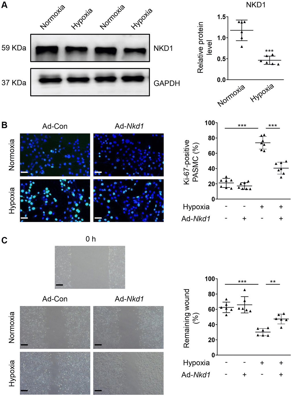 NKD1 represses the proliferation and migration in hypoxia-treated PASMC. (A) The relative protein expression of NKD1 was assessed by western blotting in PASMCs after 12 h of hypoxia exposure (post hoc for LSD test; n = 6 samples). PASMCs were transfected with Ad-Con or Ad-Nkd1 and then cultured in the condition of normoxia or hypoxia. (B) Above treated PASMCs were stained with Ki-67 (green) and DAPI (blue). Representative pictures and the corresponding percentage of Ki-67-positive PASMCs were shown (post hoc for LSD test; n = 7 samples). Bar = 50 μm. (C) Migration of above-treated PASMCs were assessed by wound-healing assay (post hoc for LSD test; n = 6 samples). Bar = 200 μm. Data were shown as mean ± S.D. **P ***P 