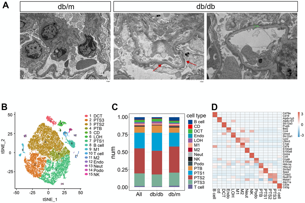 Single-cell transcriptome analysis in db/db mice. (A) Transmission electron micrographs of glomerulus from db/db and db/m mouse kidneys. The red arrow points towards the foot process fusion on the glomerular basement membrane. The green bar in the db/db image on the right side indicates the thickening of Glomerular basement membrane. (B) tSNE visualization of kidney cells from db/db and db/m mice, colored by cell type. DCT, distal convoluted tubule; PTS3, third segment of the proximal tubule; PTS2, second segment of the proximal tubule; PTB, proximal tubule brush; CD, collecting duct; LOH, loop of Henle; PTS1, first segment of the proximal tubule; B cell, B lymphocytes; M1, classical macrophage; T cell, T lymphocyte; M2, alternatively activated macrophage; Endo, endothelial cells; Neut, neutrophil progenitor; Podo, podocyte; NK, natural killer cell. (C) Bar plot showing the percentages of transcriptionally defined cell populations in db/db and db/m mice. The colors correspond to the cell types identified. (D) Heatmap of the mean expression of two manually selected marker genes in each cell type. Gene expression was standardized between –3 and 3 and is indicated by color intensity.