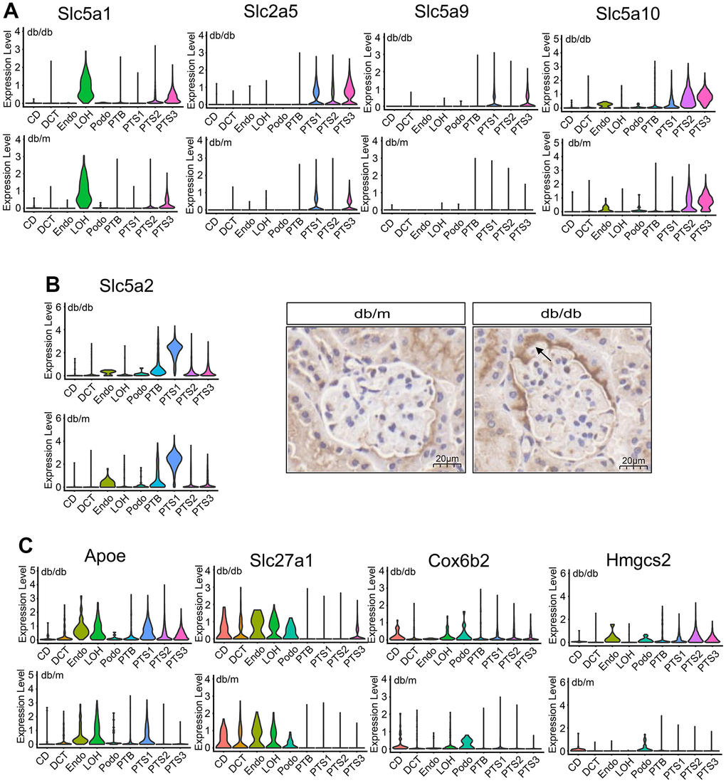 Metabolic changes in the renal tubule cells of db/db and db/m mice. (A) Violin plots showing the expression of glucose transporter in db/db and db/m mice. (B) Violin plots and immunohistochemical staining results of the expression of the Slc5a2 (SGLT2) transporter in db/db and db/m mice. Scale bar, 20 μm. (C) Violin plots showing the expression of Apoe, Slca27a1, Cox6b2, and Hmgcs2 transporters in db/db and db/m mice.