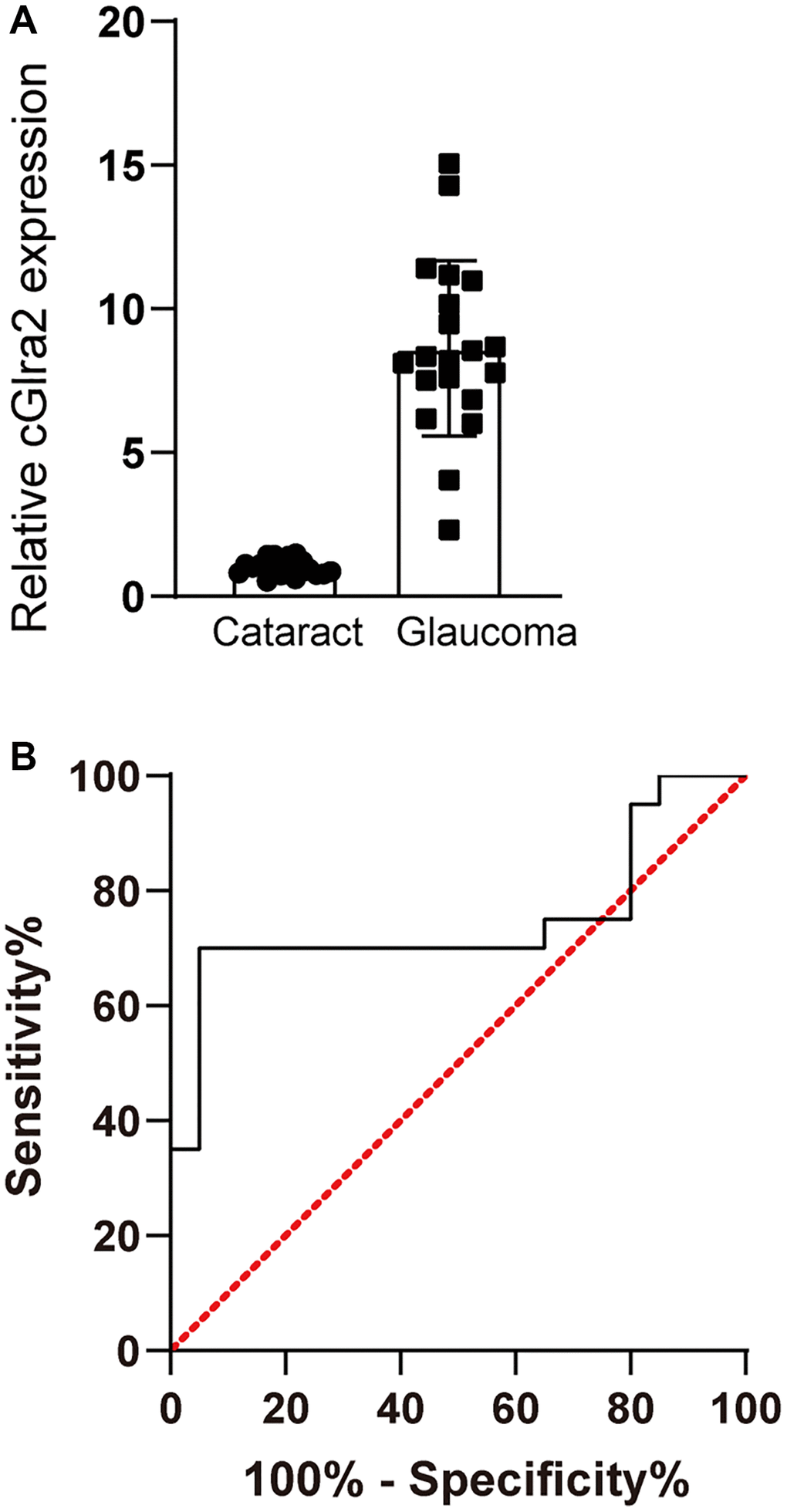 cGlra2 is shown as a potential biomarker for glaucoma. (A) AH samples were collected from glaucoma patients (n = 20) and cataract patients (n = 20). qPCR assays were conducted to detect the levels of cGlra2 expression. The significant difference was determined by Student’s t-test. (B) Receiver operating characteristic (ROC) analysis and AUC calculation was conducted to evaluate the diagnostic value of cGlra2.