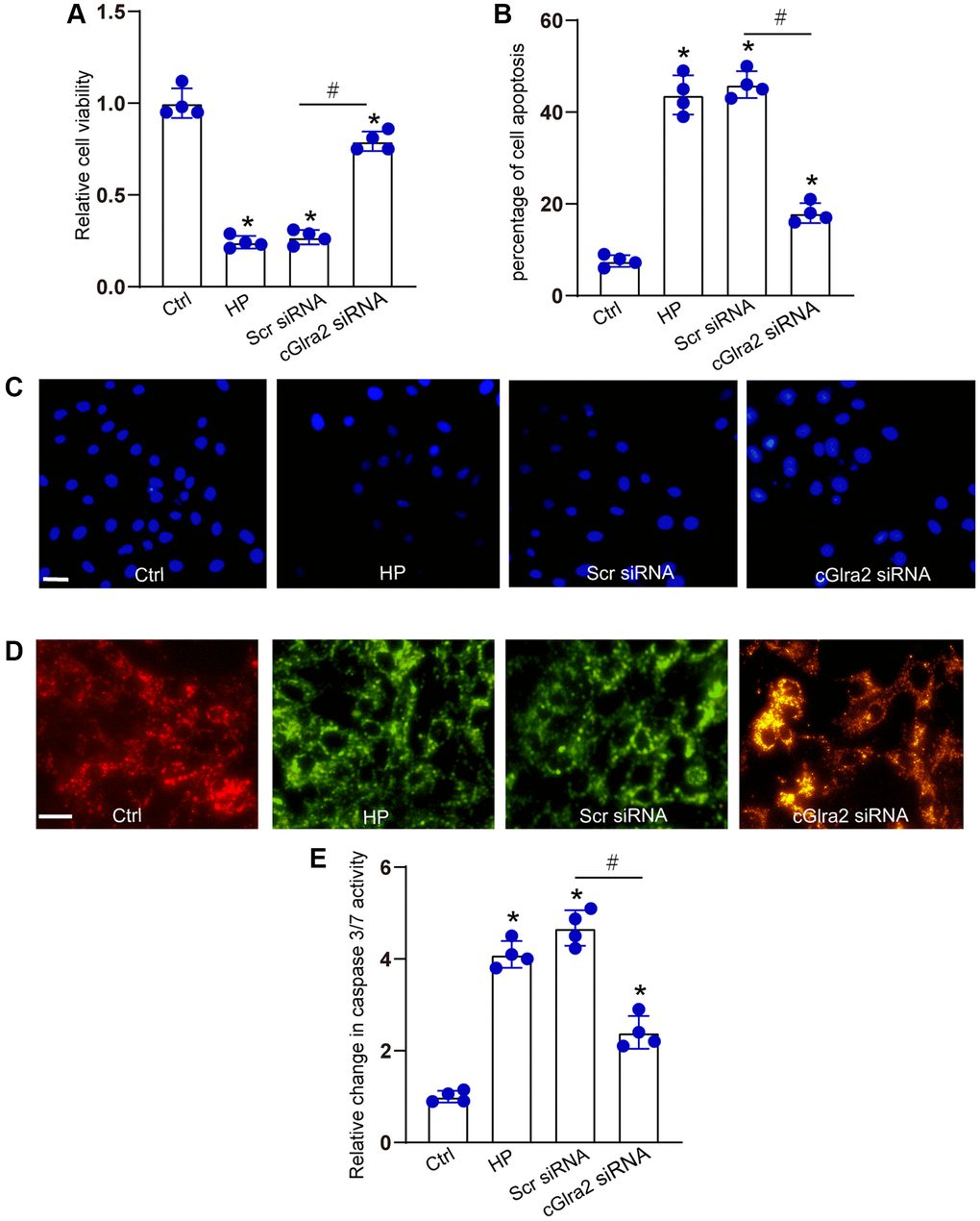 Silencing of cGlra2 protects against hydrostatic stress-induced RGC injury. RGCs were maintained under the elevated hydrostatic pressure (70 mm Hg) to induce hydrostatic stress. RGCs maintained at the ambient pressure were taken as the control group. RGCs were transfected with Scr siRNA, cGlra2 siRNA, or left untreated (Ctrl) for 12 h, and then accepted hydrostatic stress for additional 36 h. CCK-8 assays were performed to detect the viability of RGCs (A, n = 4). Hoechst staining and quantification analysis was performed to detect the changes of nuclei morphological characteristics of RGCs (B and C, n = 4, Scale bar: 50 μm). JC-1 staining was performed to change of mitochondrial depolarization in RGCs (D, n = 4, Scale bar: 50 μm). Caspase 3/7 activity was performed to detect the degree of RGC apoptosis (E, n = 4). *P #P 