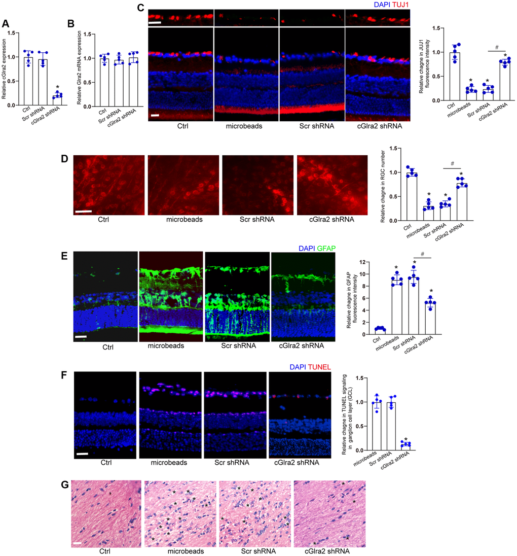 Silencing of cGlra2 alleviates retinal neurodegeneration in vivo. (A, B) C57BL/6 mice received intravitreous injections of cGlra2 shRNA, scrambled (Scr) shRNA, or left untreated for 14 days. qRT-PCRs were performed to examine the expression levels of cGlra2 (A, n = 5 animals) and Glra2 mRNA (B, n = 5 animals). (C) Normal retinas (Ctrl), microbeads-injected retinas, microbeads-injected retinas plus Scr shRNA injection, or microbeads-injected retinas plus cGlra2 shRNA injection were stained with TUJ1 to label RGCs. Scale bar, 20 μm; n = 5 animals. (D) Retinal whole-mounts following TUJ1 staining were observed from peripheral area. RGC survival was calculated by dividing the average number of TUJ1-positive cells in one field in the injured retina by that in control (Ctrl) retina (n = 5 animals, Scale bar: 20 μm). (E) Immunofluorescence staining with GFAP was conducted to detect retinal neurodegeneration at 2-month following microbeads injection (n = 5 animals, Scale bar: 20 μm). Green: GFAP-positive cells; Blue: DAPI. (F) TUNEL assays were performed to detect retinal apoptosis at 2-month following anterior chamber injections of microbeads (n = 5 animals, Scale bar: 50 μm). Red: TUNEL-positive cells; Blue: DAIP. (G) Degeneration of RGC axons was detected by H&E staining (n = 5 animals, Scale bar: 20 μm). Three photographs were taken at 40 × magnification for each nerve (photograph from the proximal, central, and distal portion of optic nerve). “*” in Figure 7G indicated the swellings in RGC axons. *P #P 