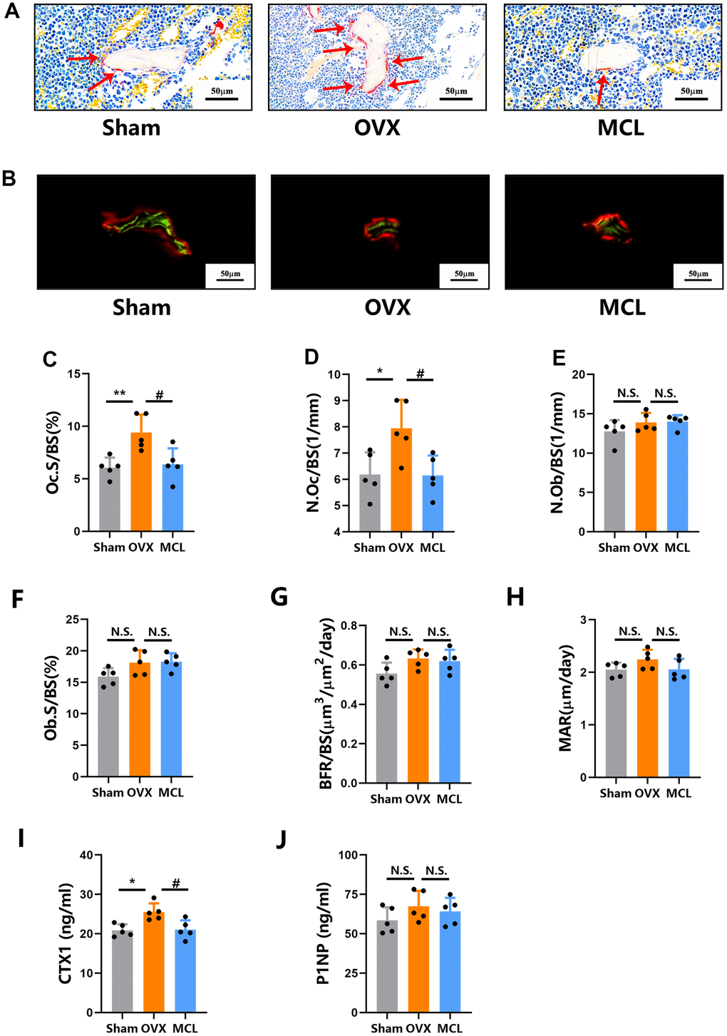 Micheliolide attenuated OVX induced excessive osteoclast bone resorption without affecting bone formation. Fifteen wild type female mice were randomly split into 3 groups (Sham group, OVX group and MCL group) as described in Figure 1. (A) Representative images of the plastic section TRAP staining pictures. Red arrows demonstrate stained TRAP positive osteoclasts. Scale bar = 50um. (B) Representative pictures of calcein (green) and alizarin red (red) labels were visualized. Scale bar = 50um. (C, D) The OcS/BS and N.Oc/BS were measured by TRAP staining sections. (E, F) N.Ob/SB and ObS/BS were measured by Toluidine Blue staining sections. (G, H) BFR/BS and MAR were measured by undecalcified sections. (I, J) The serum level of CTX1 and P1NP were evaluated. All data: mean ± SD, n=5, *p 