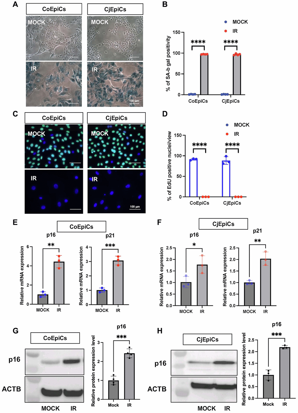 Characteristic of X-irradiated corneal and conjunctival epithelial cells. (A) SA-β-gal expression in irradiated (IR) or non-irradiated (MOCK) CoEpiCs and CjEpiCs. (B) Percentage of SA-β-gal positivity (n = 4). (C) EdU incorporation in irradiated or non-irradiated CoEpiCs and CjEpiCs. (D) Percentage of EdU positivity (n = 3). (E) RNA expression analysis of p16 and p21 in irradiated or non-irradiated CoEpiCs (n = 3). (F) RNA expression analysis of p16 and p21 in irradiated or non-irradiated CjEpiCs (n = 3). (G) Protein expression analysis of p16 in irradiated or non-irradiated CoEpiCs (n = 3). (H) Protein expression analysis of p16 in irradiated or non-irradiated CjEpiCs (n = 3). Gene expression was normalized to the housekeeping gene GAPDH. *p **p ***p 