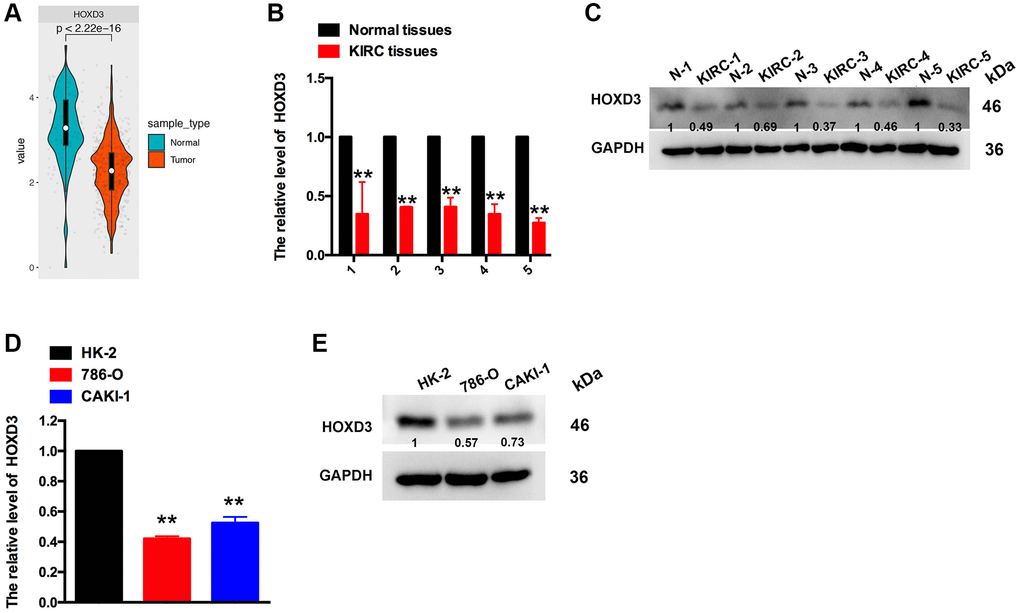 The expression of HOXD3 in KIRC tissues and cell lines. (A) HOXD3 expression was suppressed in KIRC tumor samples compared to normal tissue in the TCGA database. (B, C) The HOXD3 mRNA and protein levels were evaluated by qRT-PCR and western blotting in the KIRC tumor and normal tissue. (D, E) The HOXD3 mRNA and protein levels were identified by qRT-PCR and western blotting in 786-O, CAKI-1, and HK-2 (**p 