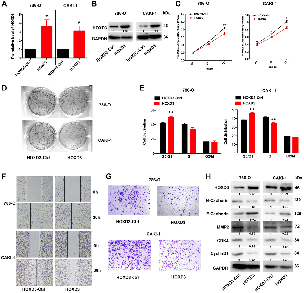 HOXD3 overexpression inhibits proliferation in ccRCC cells. (A, B) The expression level of HOXD3 at mRNA and protein levels was assessed by qRT-PCR and western blotting when 786-O and CAKI-1 cells were transfected with HOXD3-Ctrl and HOXD3. (C) The cell viability of ccRCC cells was examined by MTT assay at 24 h, 48 h, and 72 h. (D) Clone formation assay was used to test the colonies number of 786-O and CAKI-1 cells which were transfected with HOXD3-Ctrl and HOXD3. (E) Cell cycles were determined in 786-0 and CAKI-1 cells after transfection of the HOXD3 overexpression vector or HOXD3-Ctrl. The histogram indicates the percentage of cells at G0/G1, S, and G2/M cell-cycle phases. (F, G) The wound healing and transwell assays were applied for verifying the migration and invasion ability of HOXD3 and control-transfected human ccRCC. Scale bar, 100 μm. (H) The expression of N-cadherin, E-Cadherin, MMP2, CDK4, and CyclinD1 was demonstrated by western blotting in both 786-O and CAKI-1 cells of HOXD3 overexpression (p 