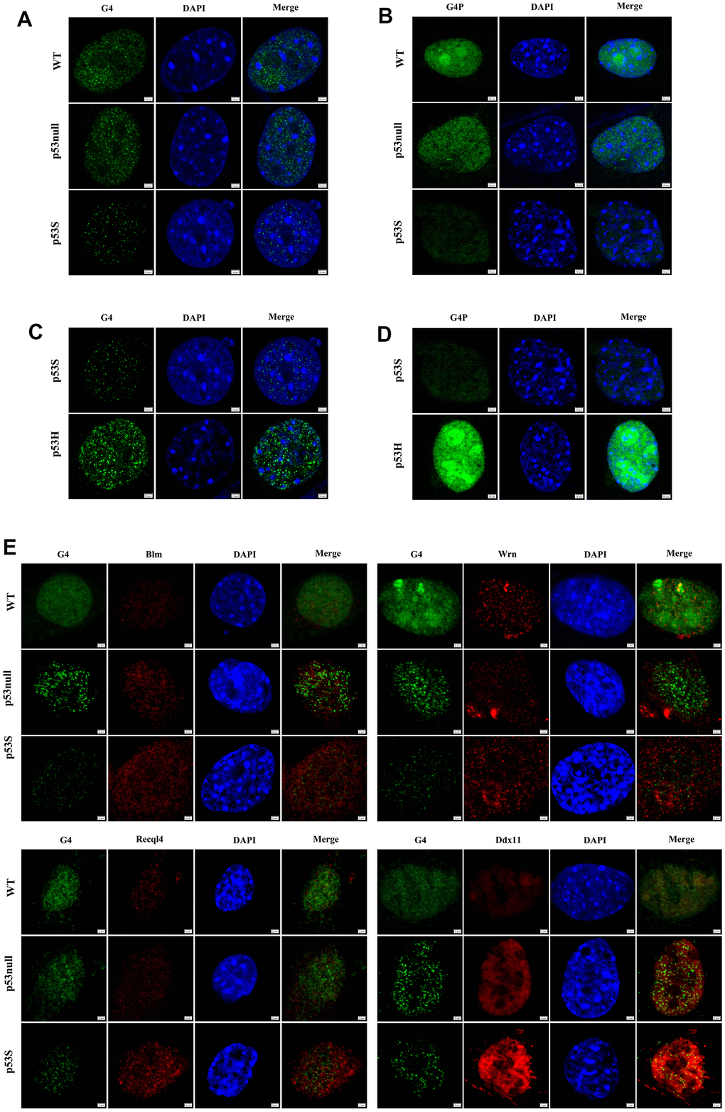 The p53S reduced the presence of G4 structure by promoting the DNA helicase expression and colocalization with G4. (A) Detected by immunofluorescence with G4 antibody, the presence of G4 structure decreased in p53S cells comparing with p53null and WT cells, suggesting a smoother unwinding of G4 structure. (B) Detected by specific G4 binding protein G4P labeled with GFP, the presence of G4 structure decreased in p53S cells comparing with p53null and WT cells. (C) The comparison of the G4 content between p53S and p53H cells by immunofluorescence with G4 antibody. (D) The comparison of the G4 content between p53S and p53H cells by specific G4 binding protein G4P. (E) The p53S promoted the expression and colocalization of DNA helicases with G4 structure.