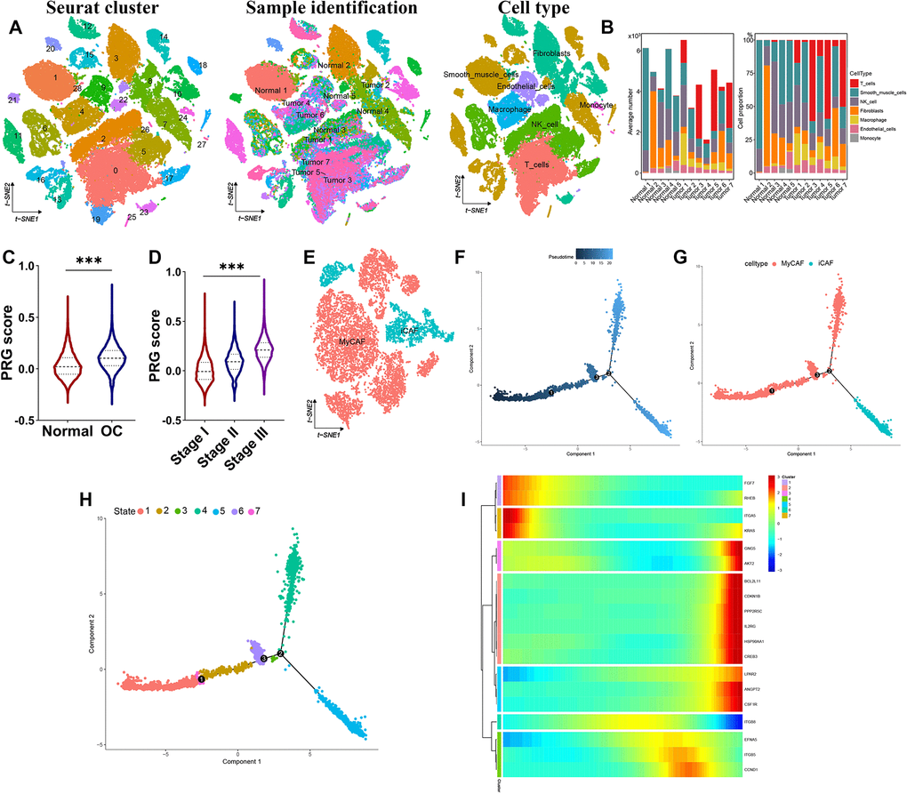 High-resolution revealing immune landscape of ovarian cancer. (A) t-SNE plot showing the identified cell types of all ovarian cancer and normal sample. (B) Fraction of cell types originating from each sample. (C, D) PI3K/Akt pathway related signature score in normal sample and ovarian cancer tissues. (E) Further sub-cell types of CAF cells. (F–H) Developmental trajectory of CAF cells inferred by monocle, colored by pseudotime, cell subtype and state. (I) Heatmap of the expression of PI3K/Akt pathway related signature genes in the developmental trajectory of CAF cells state. ***p