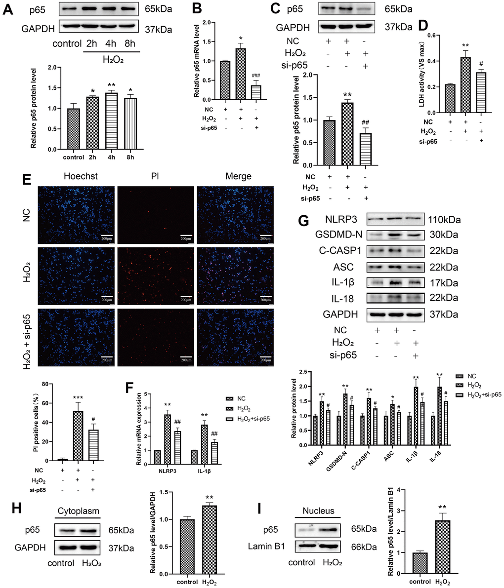 Effect of p65 on the H2O2-induced pyroptosis of HAECs. (A) Western blot demonstrating the increased protein levels of p65 upon H2O2 treatment in a time-dependent manner. (B) qRT-PCR results demonstrating the decreased mRNA expression of p65 in cells transduced with si-p65 compared with that in untransduced cells. (C) Western blot demonstrating the decreased protein expression of p65 in cells transduced with si-p65 compared with that in untransduced cells. (D) LDH release from HAECs treated with or without si-p65 following H2O2 treatment. (E) PI staining results of the increased percentage of PI positive cells in H2O2-treated HAECs. Double staining of PI (red) and Hoechst 33342 (blue). The percentage of PI positive cells in H2O2-treated HAECs decreased after transfection with si-p65. Plotting scale = 200 μm. (F) qRT-PCR results demonstrating the increased mRNA expression of NLRP3 and IL-1β in HAECs under H2O2 treatment, and decreased mRNA expression of NLRP3 and IL-1β in HAECs transduced with si-p65 compared with cells transduced with NC under H2O2 treatment. (G) Western blot results demonstrating the decreased protein expression of NLRP3, GSDMD-N, C-caspase-1, ASC, IL-1β, and IL-18 in HAECs transduced with si-p65 compared with cells transduced with NC under H2O2 treatment. Western blot demonstrating the increased protein expression of p65 in the cytoplasm (H) and nucleus (I) of H2O2-treated HAECs compared with NC-treated cells. The p65 protein levels in nucleus were obviously increased. (*p**p***p#p2O2, ##p2O2. ###p2O2). Data are presented as mean ± SD (n=3). HAECs, human aortic endothelial cells; LDH, lactate dehydrogenase; qRT-PCR, quantitative real-time polymerase chain reaction; PI, propidium iodide; NC, negative control.