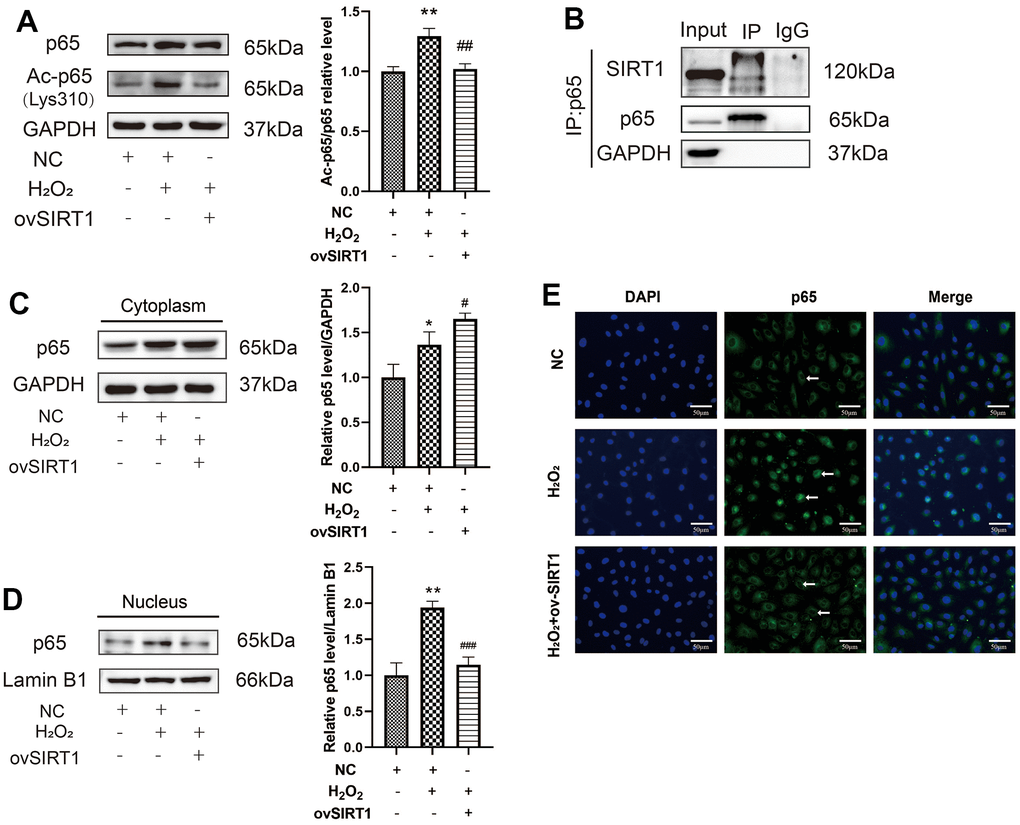 Effect of SIRT1 deacetylation on p65 in H2O2-induced pyroptosis of HAECs. (A) Western blot demonstrating the increased protein expression ratio of Ac-p65 (Lys310)/p65 in the H2O2 group compared with the NC group. The overexpression of SIRT1 protein levels decreased the protein expression ratio of Ac-p65 (Lys310)/p65 compared with that in cells treated with H2O2. (B) Endogenous IP Western revealed the pulling down of the HAEC extracts with either a negative control (IgG) or RelA/p65 antibody, followed by SIRT1 or RelA/p65 immunoblot. (C) Western blot demonstrating the increased p65 protein levels in the cytoplasm of H2O2-treated HAECs compared with NC-treated cells. Overexpression of SIRT1 protein levels increased the p65 protein levels in the cytoplasm compared with that in cells treated with H2O2. (D) Western blot demonstrating increased p65 protein levels in the nucleus of H2O2-treated HAECs compared with NC-treated cells. Overexpression of SIRT1 protein levels decreased p65 protein levels in the nucleus compared with that in cells treated with H2O2. (E) Double staining of p65 (green) and DAPI (blue). DAPI staining results of the nucleus of HAECs. P65 staining results of increased p65 in the nucleus of H2O2-treated HAECs; the level decreased after transfection with ov-SIRT1 in H2O2-treated HAECs under a fluorescence microscope. Plotting scale =50 μm. (*p**p#p2O2, ##p2O2). Data are presented as mean ± SD (n=3). HAECs, human aortic endothelial cells; NC, negative control; IP, immunoprecipitation; DAPI, 4′,6-diamidino-2-phenylindole.