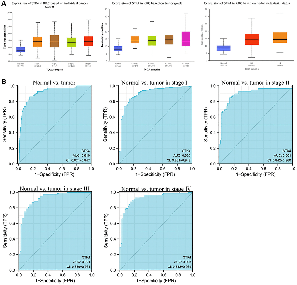 STK4-associated clinical pathology characteristics of patients with ccRCC (also called kidney renal clear cell carcinoma, KIRC). (A) The expression of STK4 is based on the tumor stage, tumor grade, and nodal metastasis status. (B) The ROC curve of STK4 in patients with ccRCC.