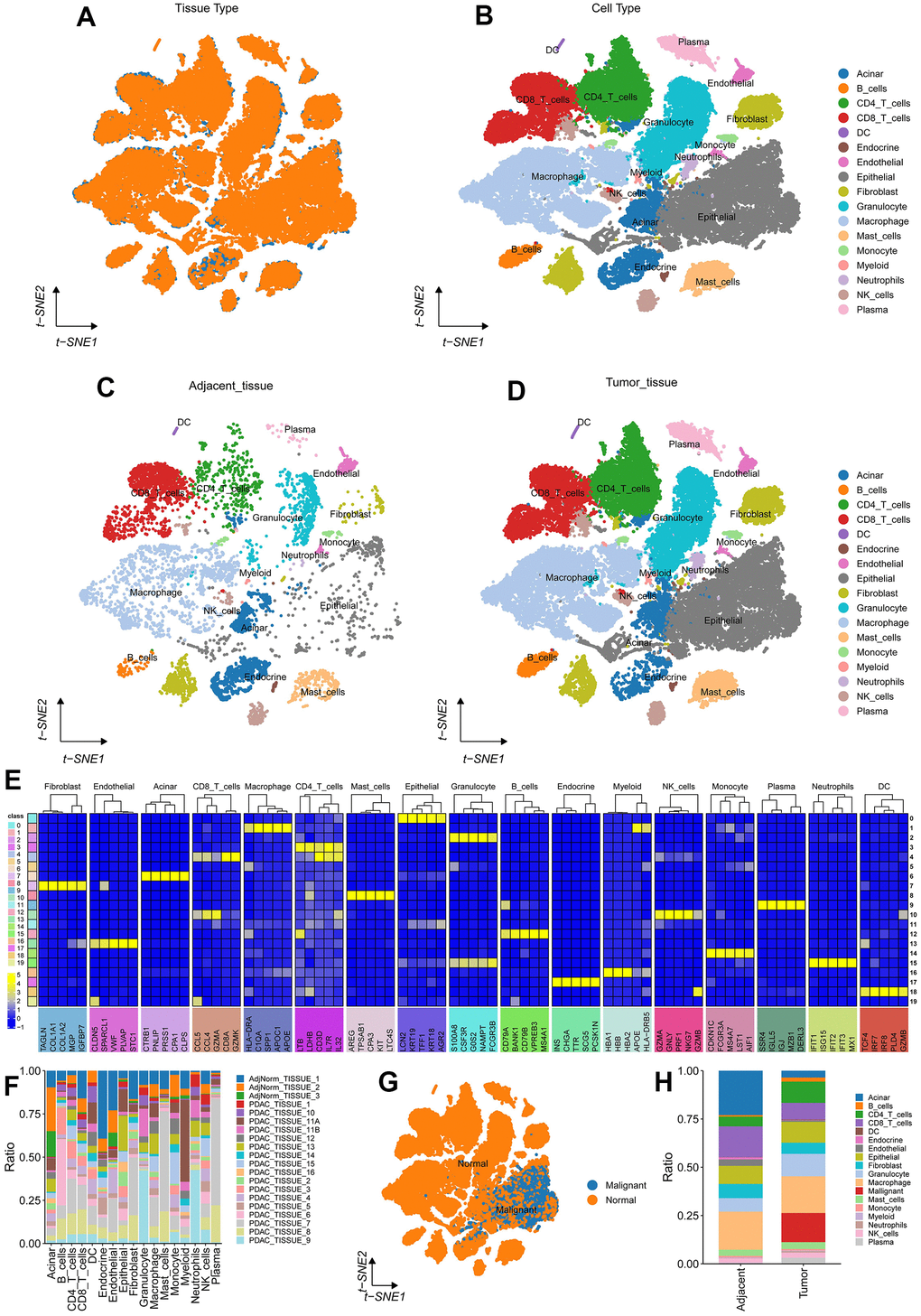 Pancreatic cancer single cell dimension reduction annotation. (A, B) tSNE on Tumor(yellow)/Adjacent(blue) and all patient tissues. (C, D) tSNE on 3 adjacent/normal pancreas (left) and 16 PDA patient (right) tissues. (E) Top 5 marker basis for each cell type; (F) Cell count statistics for each sample; (G) Copykat prediction results; (H) The proportion of various cell types adjacent to the tumor.