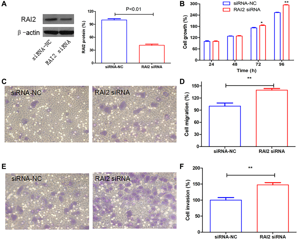RAI2 knockdown promoted the growth, cell migration, and invasion in GC cells. (A) The knockdown efficiency of RAI2 in GC cell line MGC803 using siRNA. (B) The AlamarBlue assay of cell proliferation in MGC803 cells transfected with siRNA NC or RAI2 siRNA. (C–F) The Transwell cell migration and invasion abilities were assessed in MGC803 cells using RAI2 siRNA. **P *P 