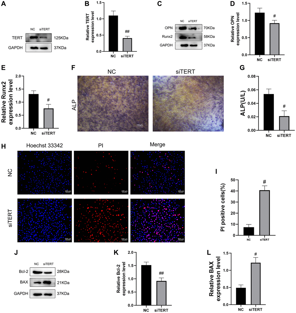 Validation of the effect of TERT on osteogenic differentiation and apoptosis in BMSCs. (A, B) The siRNA-mediated depletion of TERT assessed by western blotting. (C–E) The specific proteins related to osteogenesis differentiation detected by Western blotting, including OPN and Runx2. (F) ALP staining in NC group and TERT-depleted BMSCs. (G) ALP activity detected by ALP activity assay kit in NC group and TERT-depleted BMSCs. (H, I) The Hoechst 33342/PI staining and quantification results. (J–L) The specific proteins related to apoptosis detected by Western blotting, including Bcl-2 and BAX. All results are performed as mean ± SD. #P ##P n = 6.