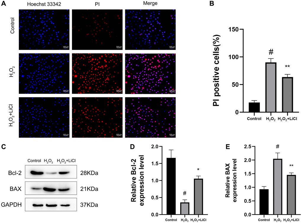 LiCl reverses H2O2-induced elevation of apoptosis in BMSCs. (A, B) The Hoechst 33342/PI and quantification results of apoptosis of BMSCs treated with H2O2 or LiCl. (C–E) Western blotting and quantification of Bcl-2 and BAX in BMSCs treated with H2O2 or LiCl. All results were performed as mean ± SD. #P *P **P 2O2 group, n = 6. Scale bar: 100 μm.