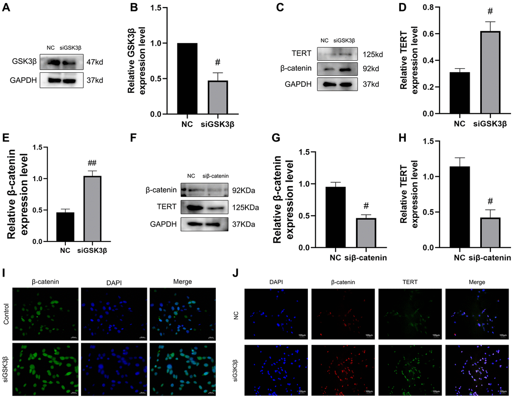 Confirmation of the GSK3β/β-catenin/TERT pathway in BMSCs. (A, B) The siRNA-mediated depletion of GSK3β was assessed by western blotting. (C–E) The specific proteins related to the pathway protein in this experiment expressed from the NC group and siGSK3β group of BMSCs were detected by Western blotting, including β-catenin and TERT. (F–H) The siRNA-mediated depletion of β-catenin and protein levels of TERT was assessed by western blotting from the NC group and siβ-catenin of BMSCs. (I) Immunofluorescence staining reveals nuclear translocation of β-catenin in BMSCs after depletion of GSK3β. (J) Immunofluorescence assays were performed to identify colocalization between β-catenin and TERT in BMSCs after depletion of GSK3β. All results were performed as mean ± SD. Scale bar: 100 μm. #P ##P n = 6.