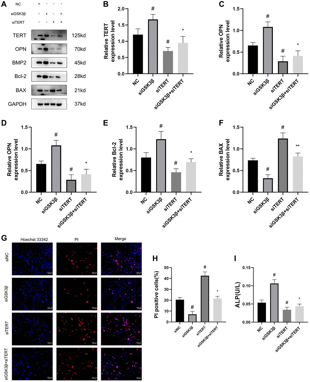 The Wnt/β-catenin pathway promotes osteogenic differentiation and inhibits the apoptosis of BMSCs through upregulating TERT expression. (A–F) Western blotting and quantification of TERT, OPN, BMP2, Bcl-2, and BAX in NC, siGSK3β, siTERT, and siGSK3β + siTERT groups of BMSCs. (G, H) The Hoechst 33342/PI and quantification results in four groups of BMSCs. (I) ALP activity assay kit to detect ALP activity in four groups of BMSCs. Scale bar: 100 μm. All results were performed as mean ± SD. #P *P n = 6.