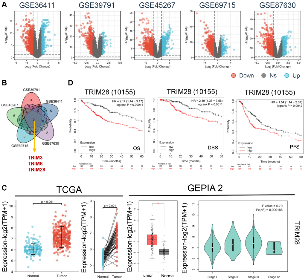 The expression levels of TRIMs protein with clinical features in HCC. (A) Differential gene expression in HCC and normal tissues from GSE36411, GSE39791, GSE45267, GSE69715 and GSE87630 (blue: overexpression, red: down expression). (B) Venny diagrams was used to take the intersection three genes (TRIM3, TRIM6 and TRIM28) from above five datasets. (C) We analyzed the expression level of TRIM28 total protein between normal tissue and HCC tissue from TCGA, p *p D) Relationship between TRIM28 expression and OS, DSS and PFS by Kaplan-Meier Plotter in HCC from TCGA databases.