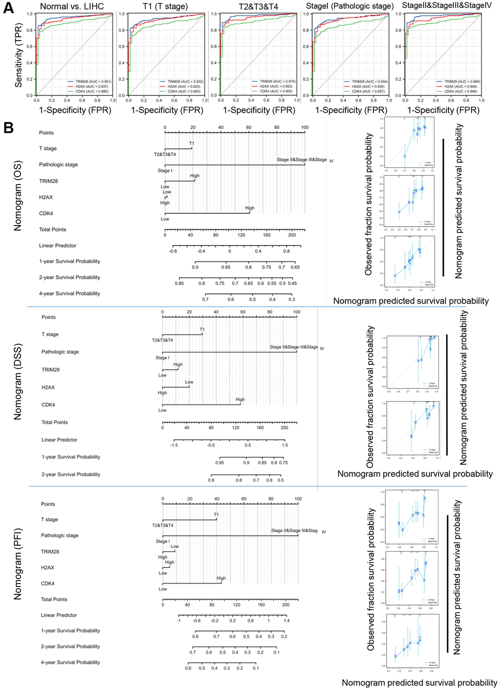 Diagnostic and prognostic values of TRIM28, H2AX and CDK4 expression in HCC. (A) The AUC for ROC curves for TRIM28, H2AX and CDK4 in normal liver tissues and HCC tissues, subgroup analysis for T1 stage, T2/T3/T4 stage, Pathologic stage I and Pathologic stage II/III/IV were computed. (B) Nomogram for predicting probability of patients with 1-, 3- and 5-year OS, DSS, PFS in entire TCGA cohort in HCC. Calibration curves of nomogram on consistency between predicted and observed 1-, 3-, and 5-year survival in entire TCGA cohort. Dashed line at 45° implicated a perfect prediction, and the actual performances of our nomogram were shown in blue lines.