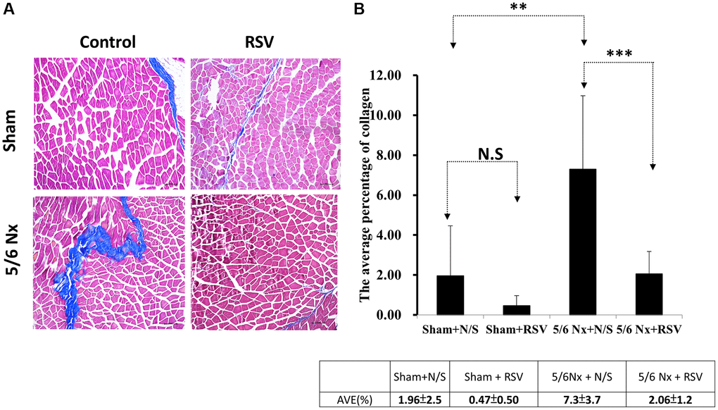 Area of collagen in skeletal muscle tissue in mice with 5/6 nephrectomy. (A) Masson’s trichrome staining of collagen fibers. (B) Area of collagen within the skeletal muscle was quantified for each group. **Sham + N/S vs. 5/6Nx + N/S, p ***5/6Nx + N/S vs. 5/6 Nx + RSV, p 