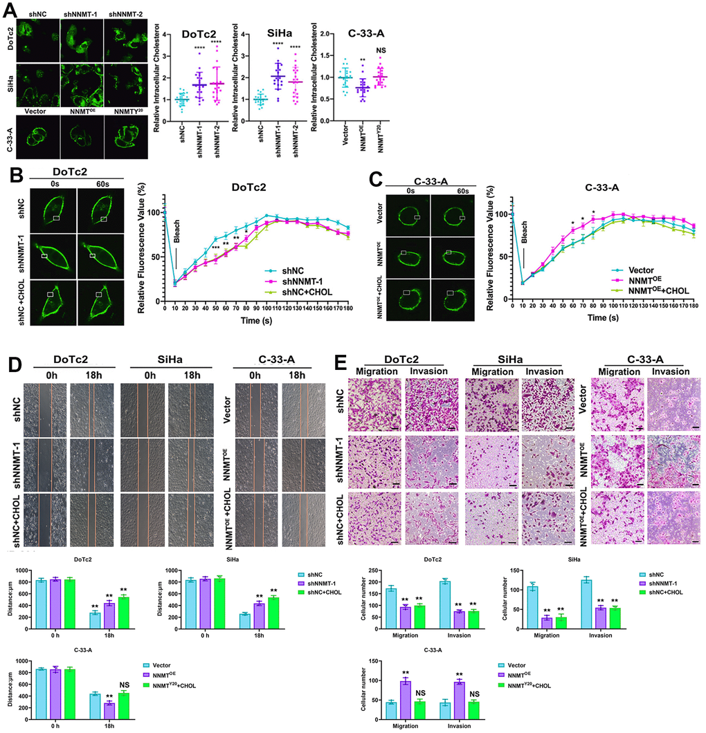 NNMT promotes migration and invasion by reducing cholesterol in EC cells. (A) Intracellular cholesterol levels detected by Amplex® Red cholesterol assay. (B, C) Representative results of Dil-C16 staining and fluorescence recovery recordings using confocal microscopy. (D) Representative results of cholesterol-treated wound healing assay. (E) Representative results of migration and invasion assays under cholesterol treatment (Scale: 100 μm). (*P 