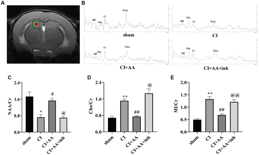 Alisol A regulated hippocampal metabolism. (A) The hippocampal CA1 region of mice was chosen as the region of interest. (B) Representative spectral image of the hippocampal CA1 region of mice. (C) Quantitative analysis of NAA/Cr. (D) Quantitative analysis of Cho/Cr. (E) Quantitative analysis of MI/Cr, n = 6. Data are presented as the mean ± SD, *P **P #P ##P @P @@P 